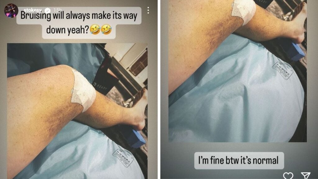 Ben Stokes Knee Surgery